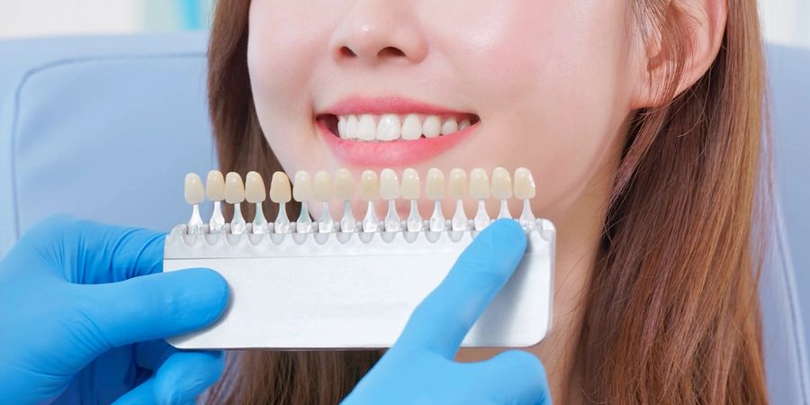 Teeth Whitening
